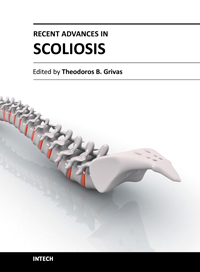 Recent Advances in Scoliosis